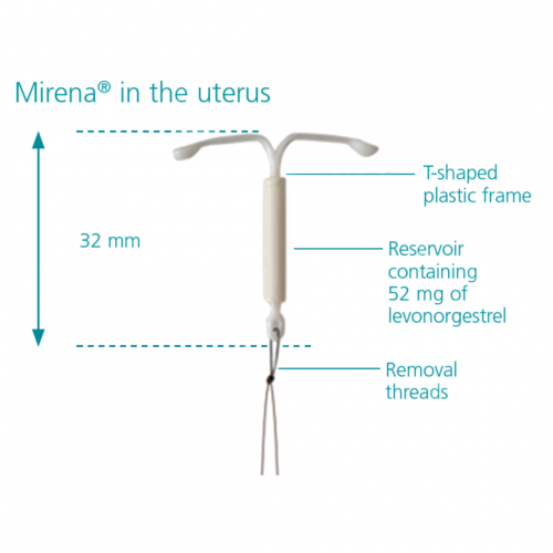 MIRENA (3) 1 KIT (Levonorgestrel (intrauterine delivery system) 52mg)